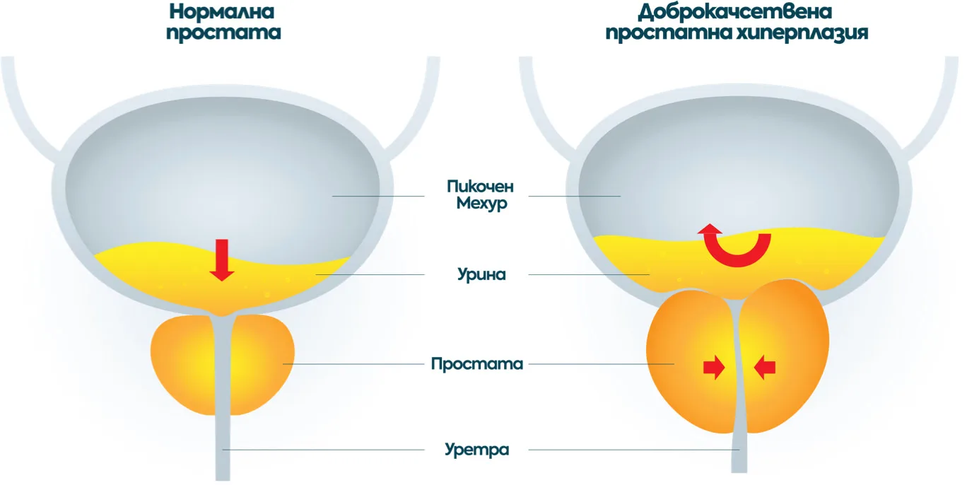 reverta-health-info-img